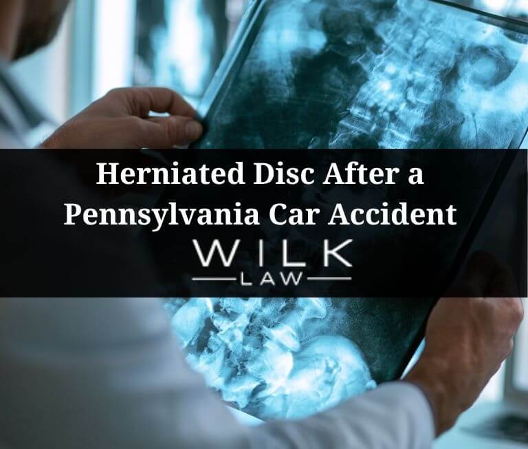 Doctor looking at x-rays of a patient's spine with a herniated disc in Philadelphia, Pennsylvania